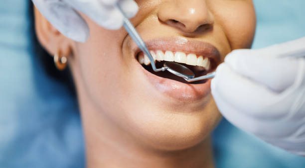 Best Emergency Cosmetic Dentistry (e.g., broken veneers) in Horseshoe Bay, TX
